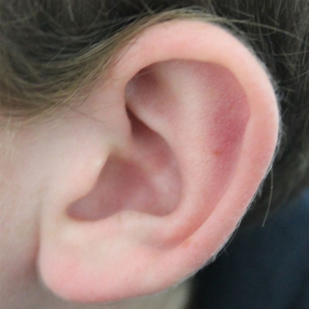 Patient Education Ear Diseases – Wichita Ear Clinic